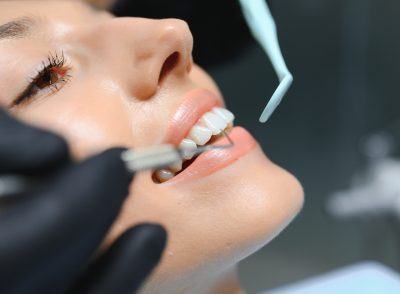 Doctor examining patient's teeth, closeup. Cosmetic dentistry.