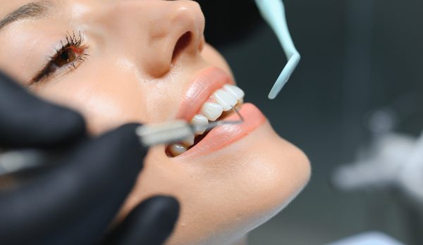 Doctor examining patient's teeth, closeup. Cosmetic dentistry.